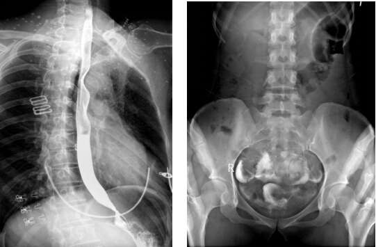 動(dòng)態(tài)DR和胃腸機(jī)有什么區(qū)別嗎？