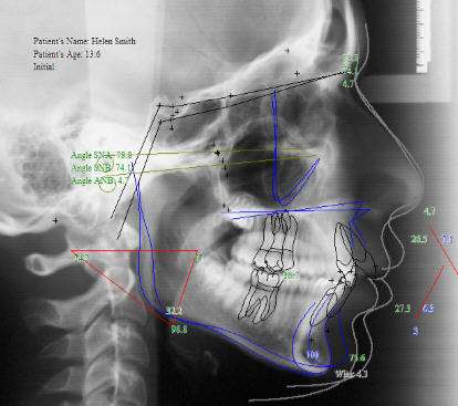 看牙齒為什么要拍片？