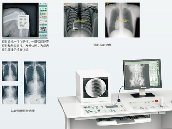 數(shù)字胃腸機(jī)