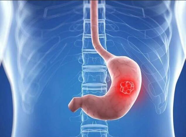 胃鏡檢查多久做一次？檢查前和檢查后注意哪些事項？