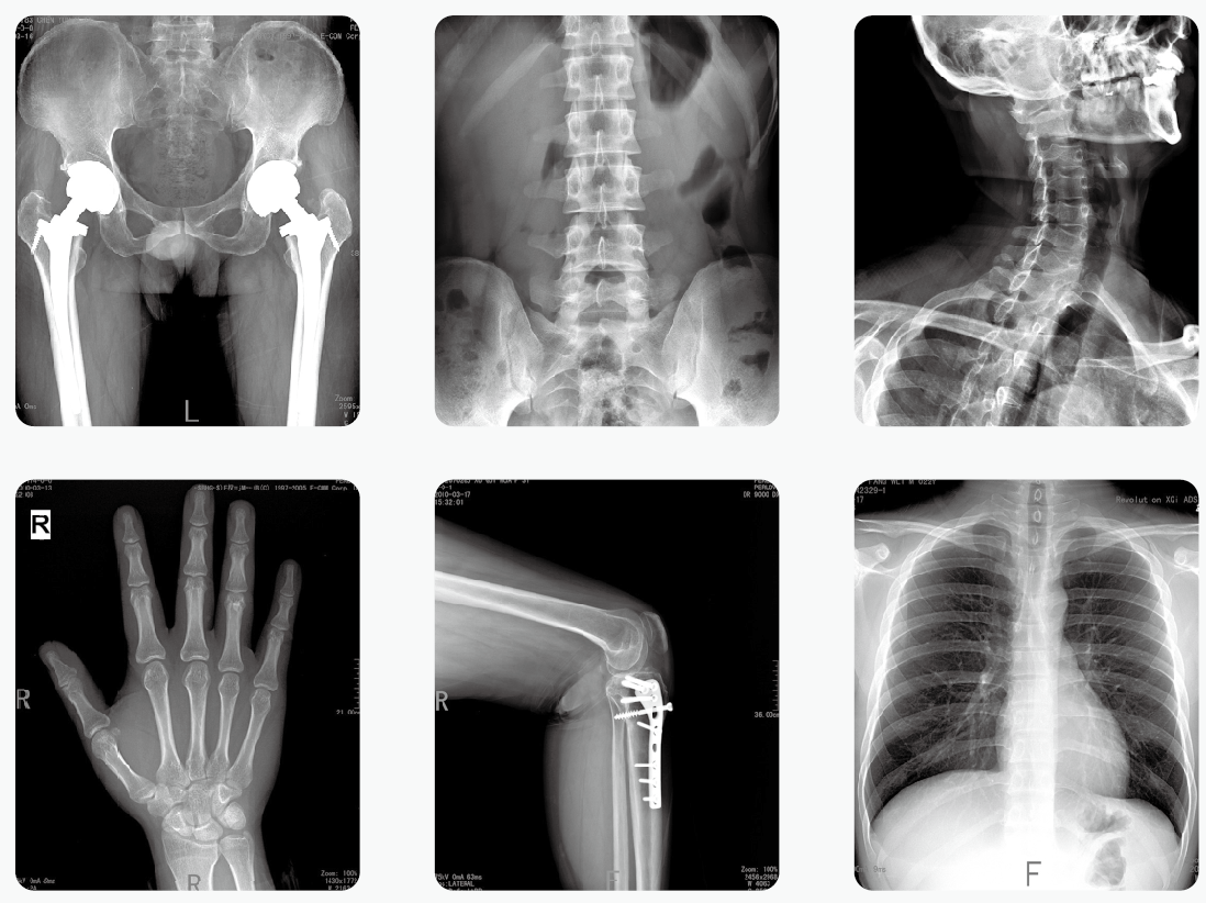 放射性醫(yī)學檢查——DR