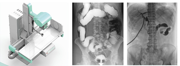 x線數(shù)字胃腸機(jī)